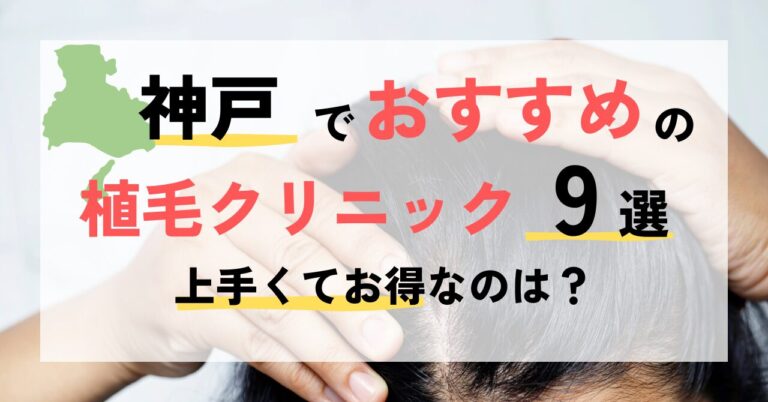 兵庫・神戸でおすすめの植毛クリニック9選！上手くてお得なのは？