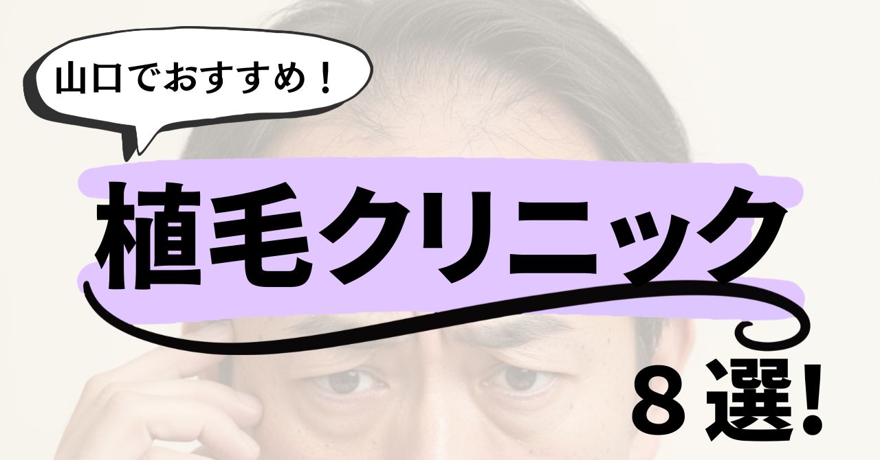 山口でおすすめの植毛クリニック8選！コスパが良いのは？のアイキャッチ