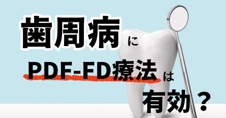 歯周病にPDF-FD療法は有効？PRPとの違い・効果・安全性をエビデンスを元に解説のアイキャッチ