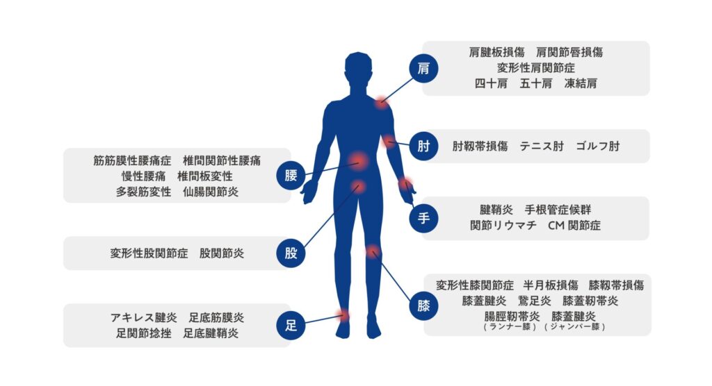 PDF-FD療法の整形外科への適応