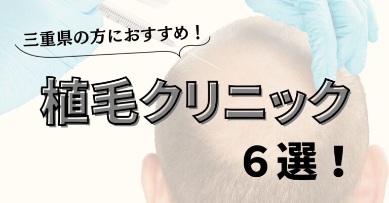 三重県の方におすすめ植毛クリニック6選！どこで施術する？のアイキャッチ