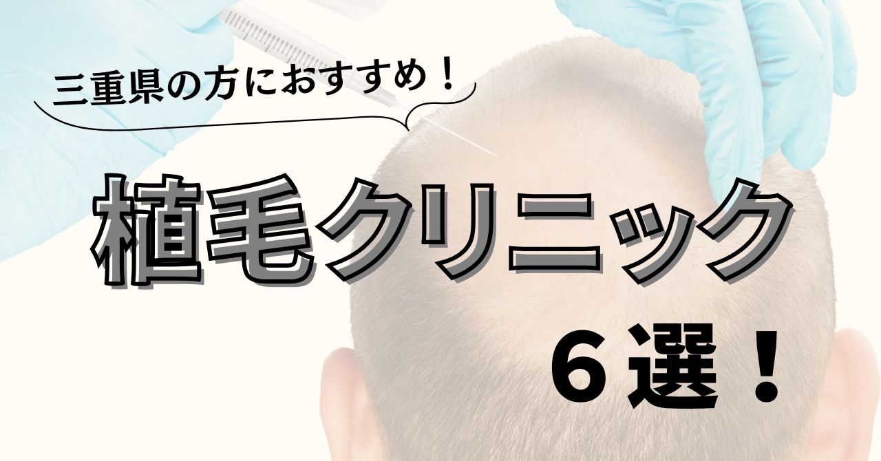 三重県の方におすすめ植毛クリニック6選！どこで施術する？のアイキャッチ
