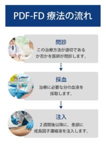 PDF-FD療法の流れ