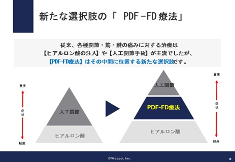 PDF-FD療法の位置づけ