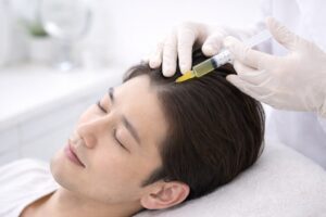 メゾセラピーを受ける男性