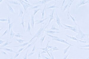 線維芽細胞の写真