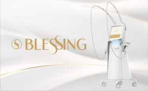 ブレッシング