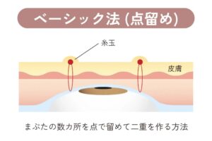 ベーシック法のイラスト