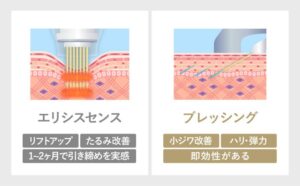 ブレッシングとエリシスセンスの違い