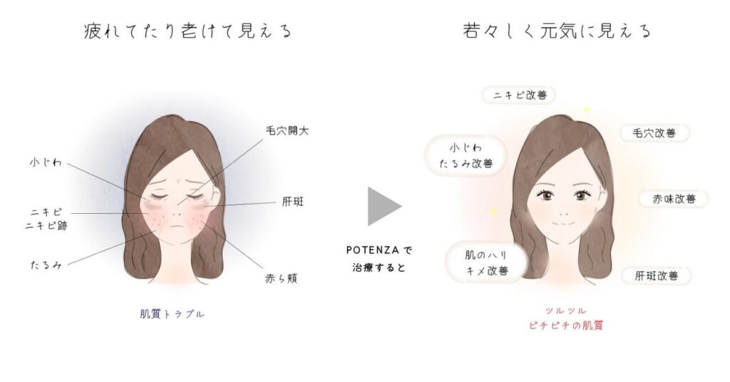 ポテンツァがおすすめの方