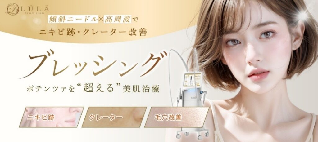ルラ美容クリニックのブレッシングのバナー