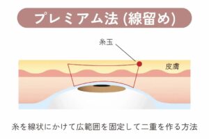 プレミアム法のイラスト