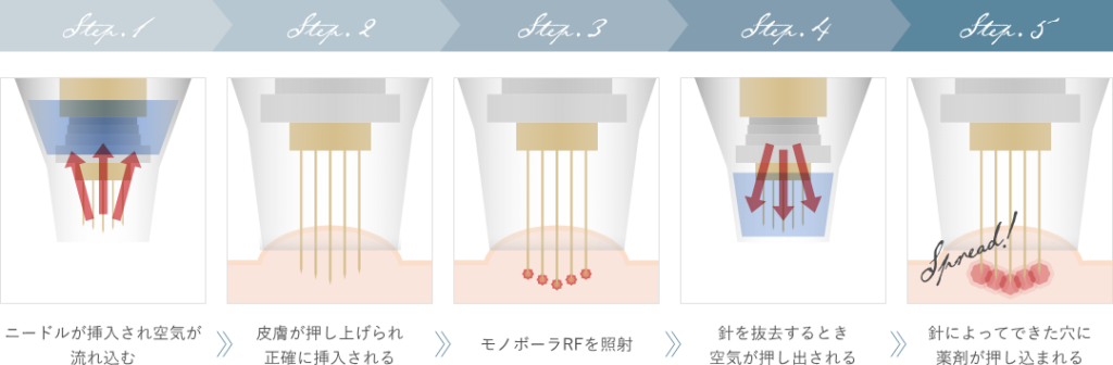 ポテンツァのメカニズム