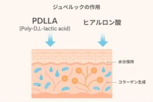ジュベルックのPDLLAとヒアルロン酸による作用