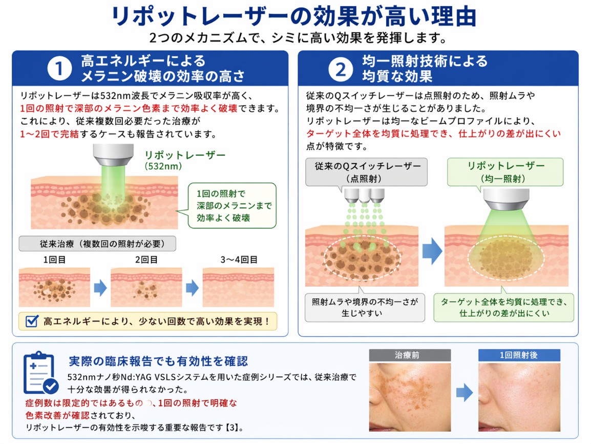 リポットレーザーの効果が高い理由