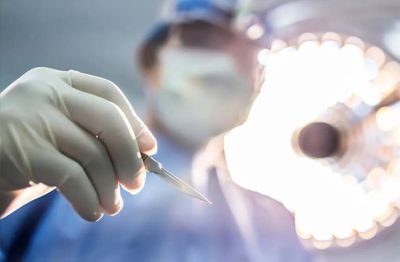 二重埋没の施術の様子