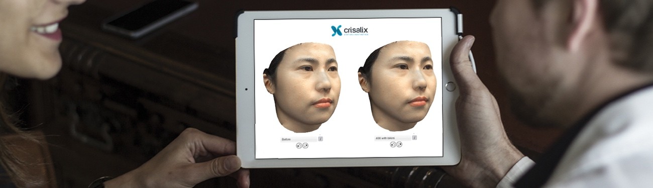 3DシミュレーションシステムCrisalix
