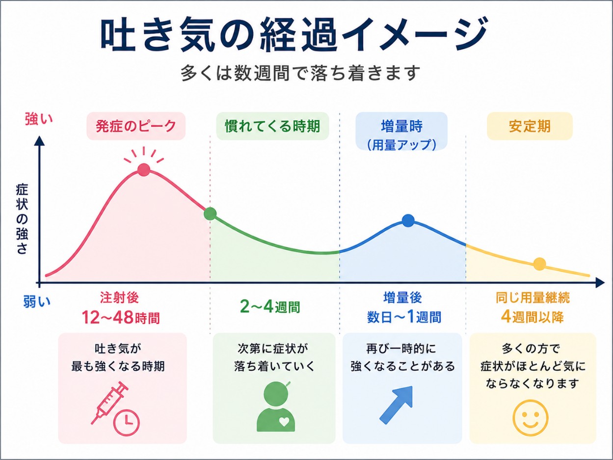 吐き気の経過イメージ