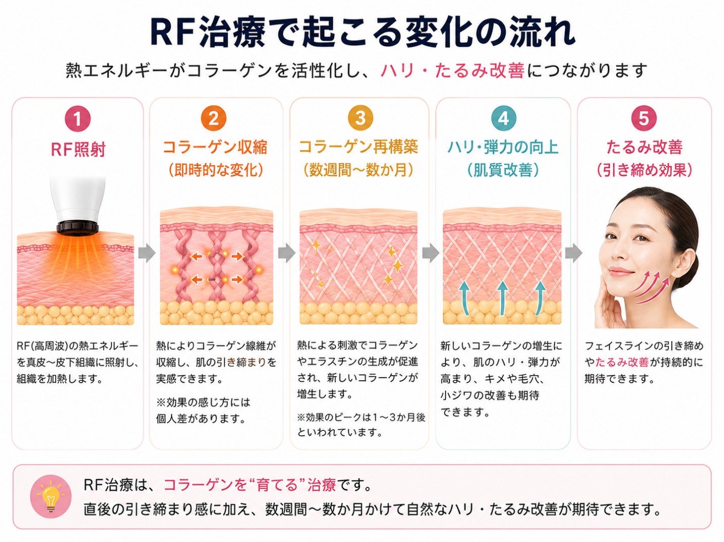 RFで期待できる効果のメカニズム