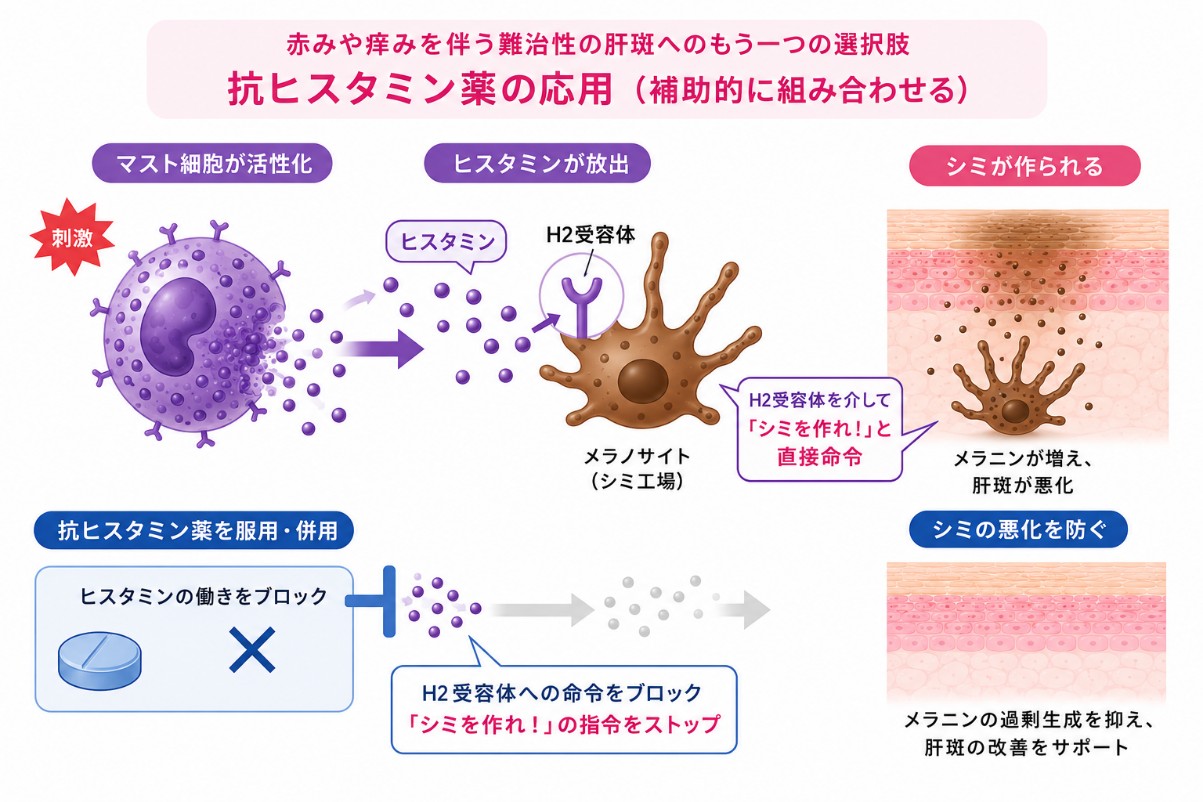 抗ヒスタミン薬の肝斑への効果のメカニズム