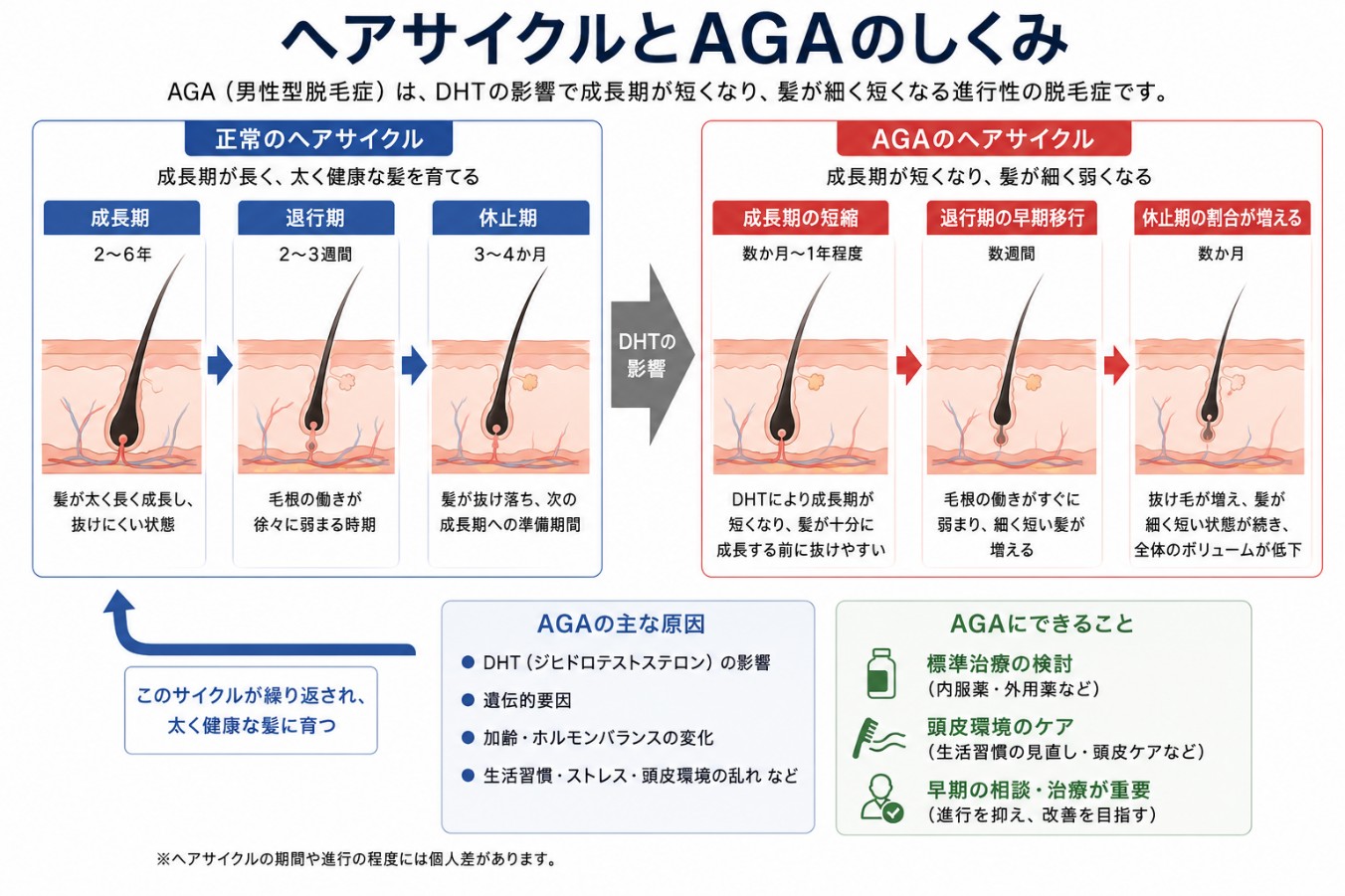 ヘアサイクルとAGAの仕組み