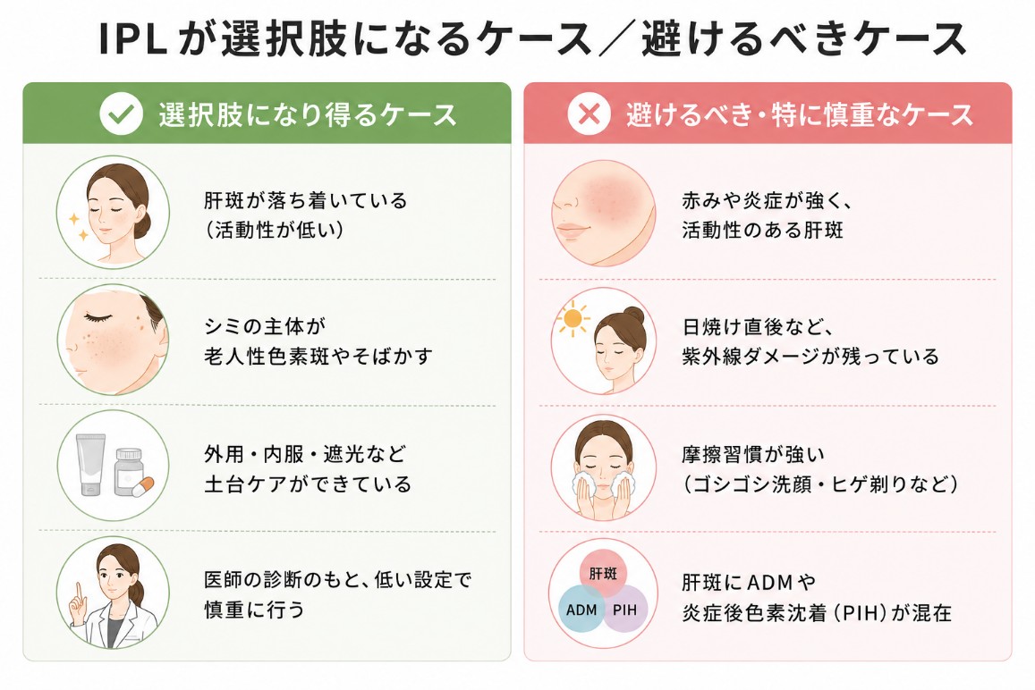  IPLの肝斑への適応・非適応
