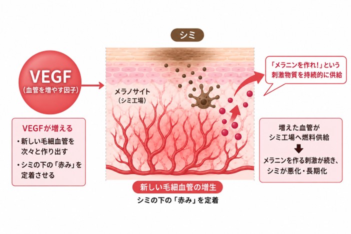 VEGFがシミに赤みを出すメカニズム
