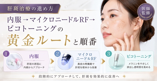 肝斑治療の進め方｜内服→マイクロニードルRF→ピコトーニングの黄金ルートと順番｜医師監修のアイキャッチ