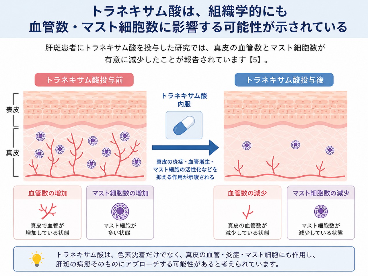 トラネキサム酸の血管数とマスト細胞数減少の効果