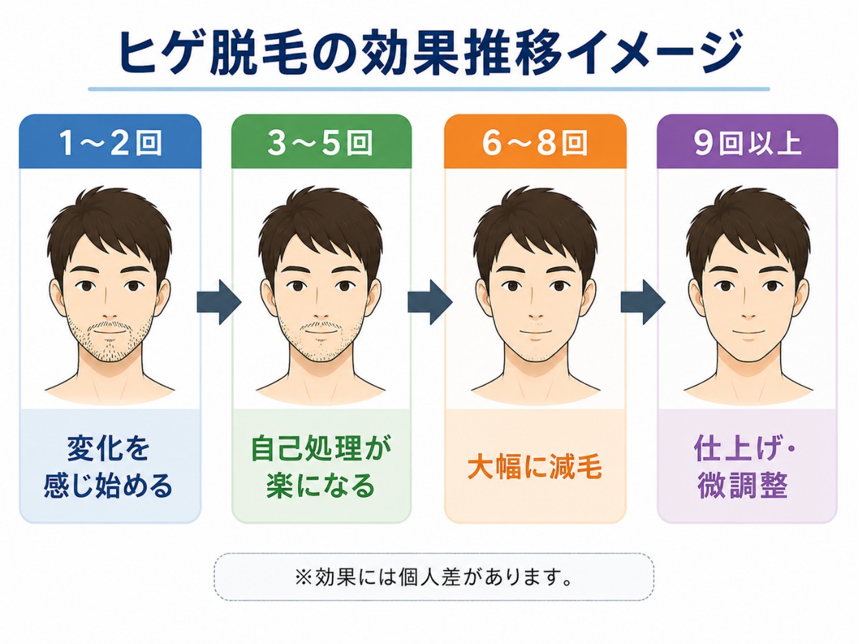 ひげ脱毛の効果の推移