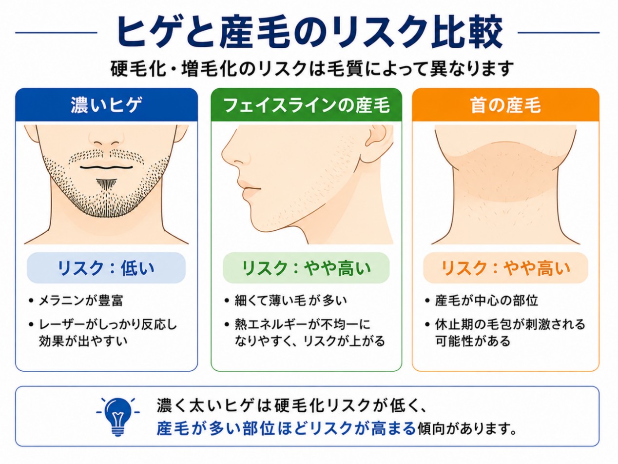 ヒゲ脱毛と硬毛化リスクの関係