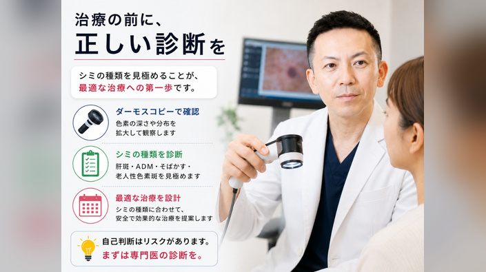 肝斑・老人性色素斑・そばかす・ADMの違いと見分け方のアイキャッチ