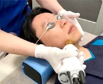 脱毛のためのレーザー照射
