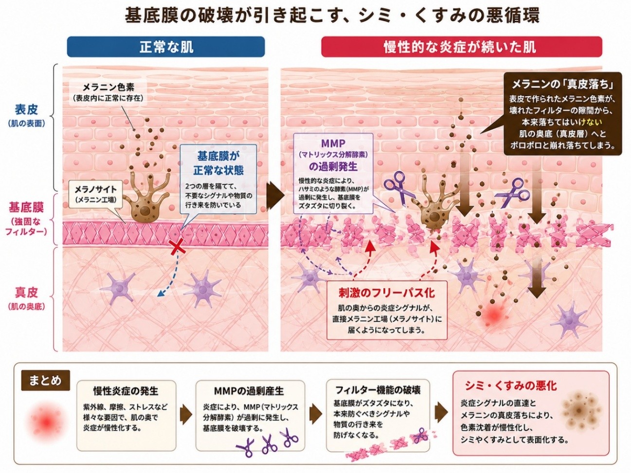 基底膜破壊のメカニズム
