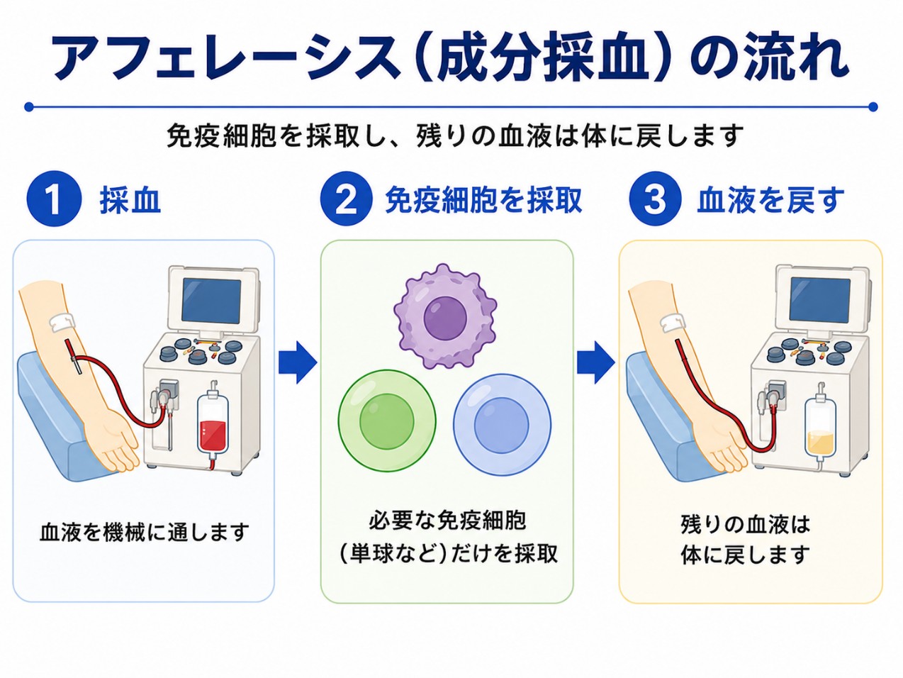 アフェレーシスの流れ