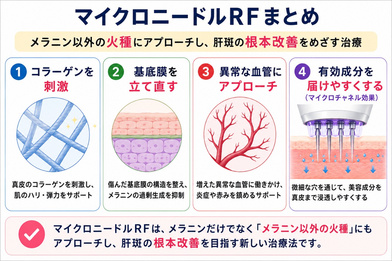 マイクロニードルRFと肝斑のまとめ
