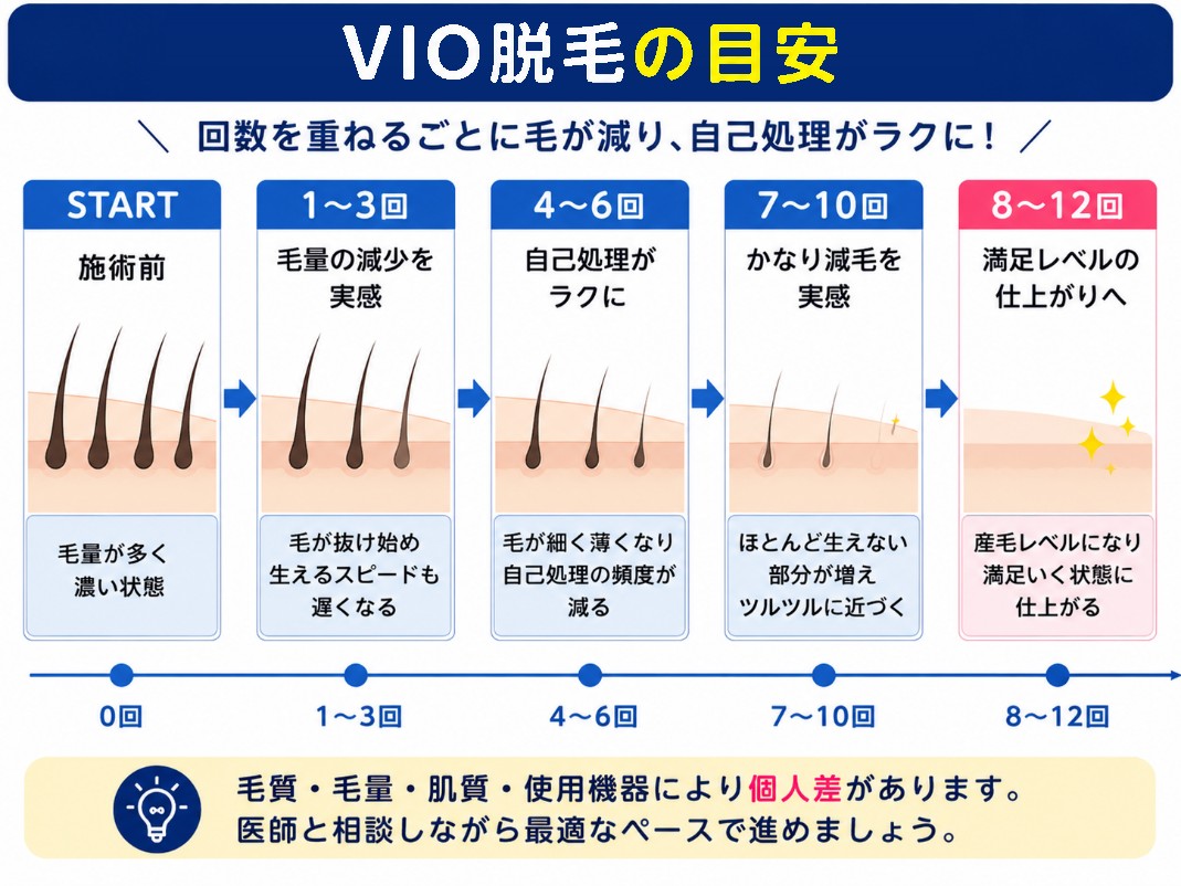 VIO脱毛の回数と期間の目安