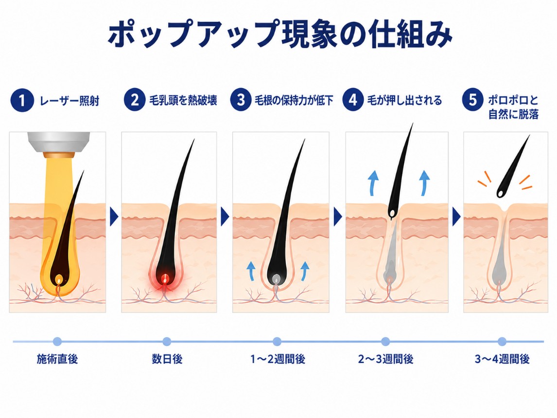 ポップアップ現象の仕組み
