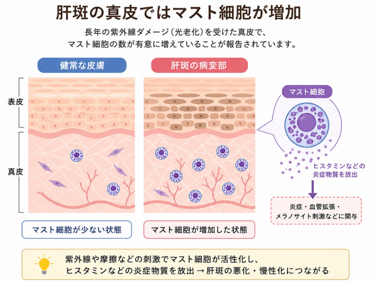 マスト細胞増加のメカニズム