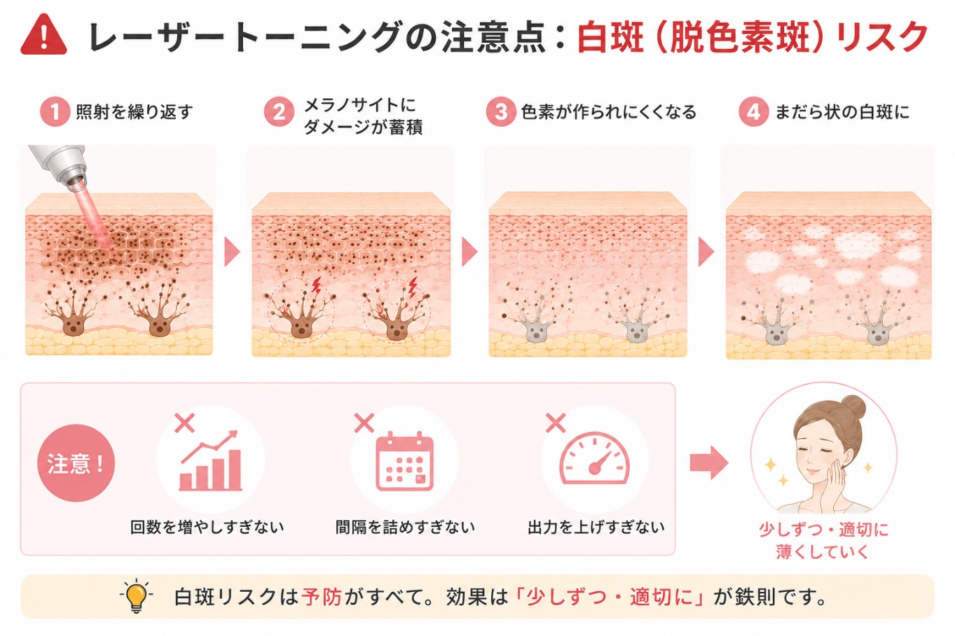 レーザートーニングの白斑（脱色素斑）リスク