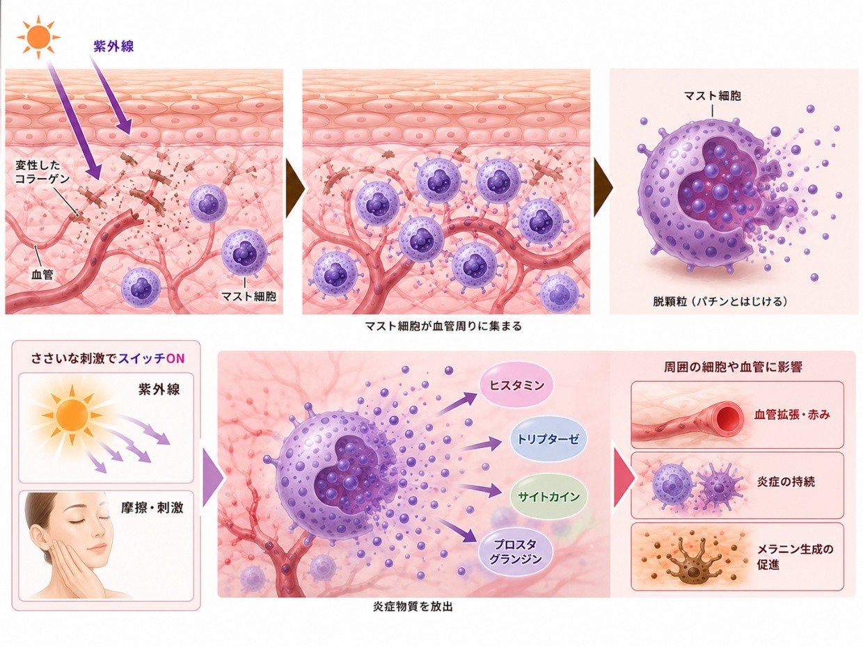 マスト細胞の肝斑発症への作用のイラスト