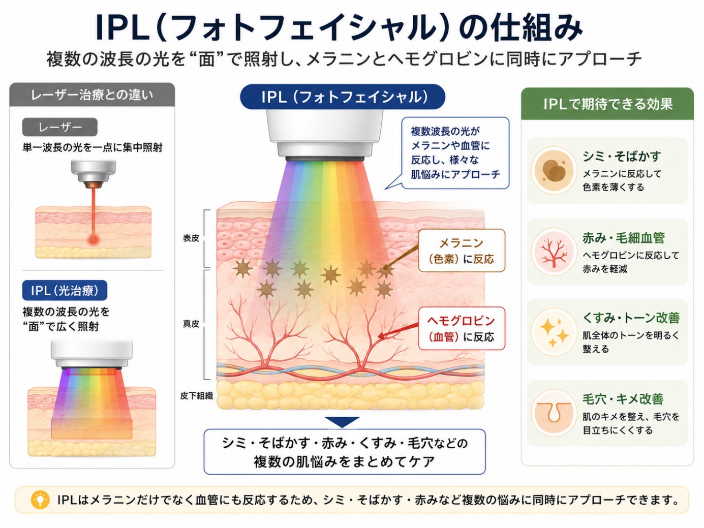  IPL（フォトフェイシャル）の仕組み（複数波長の光）
