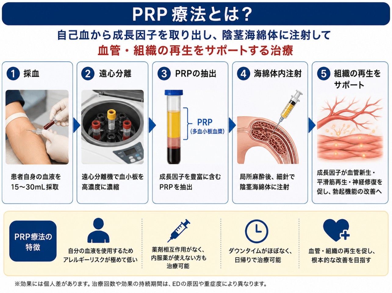 EDのPRP療法の流れを示す図
