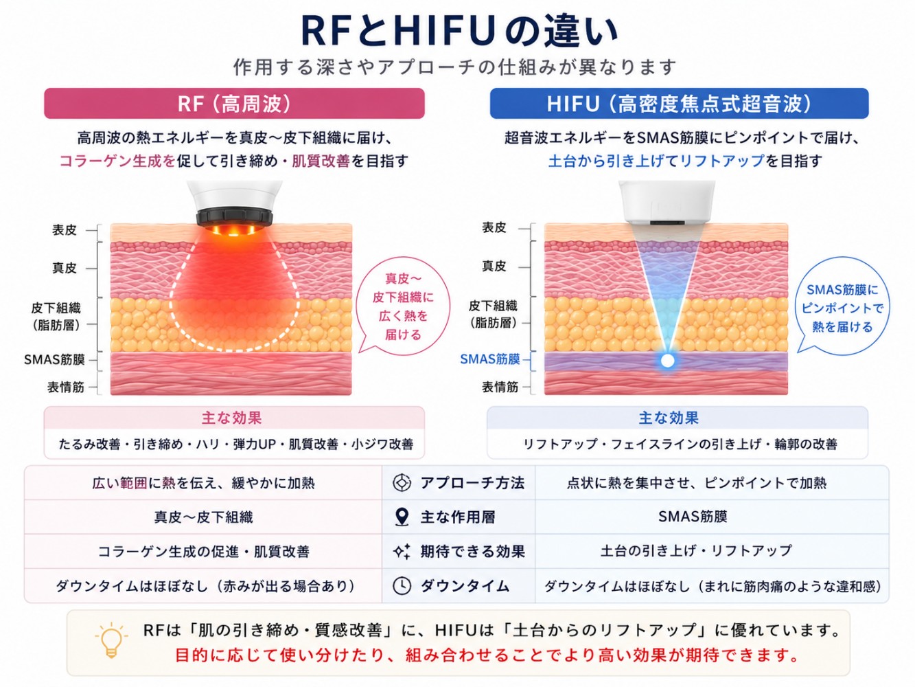 ザーフとハイフ（HIFU）の違い