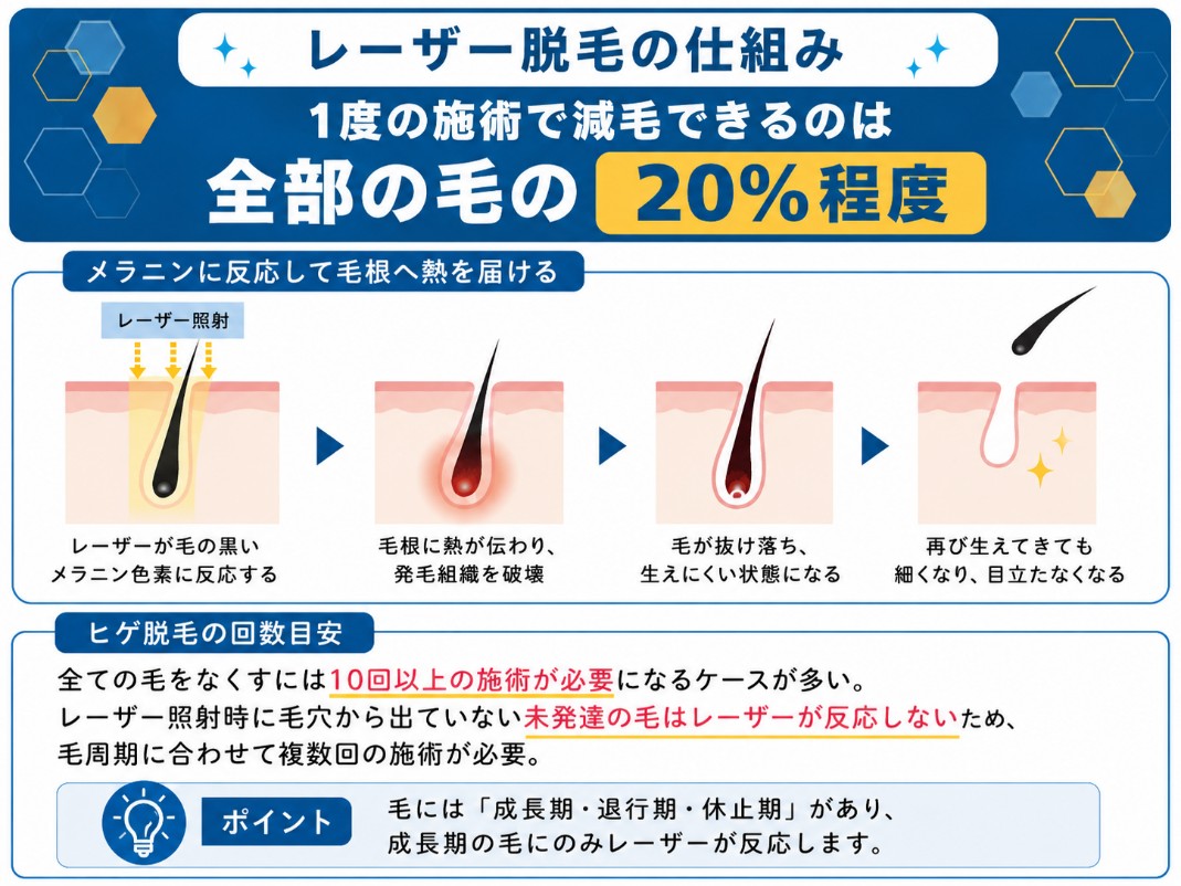 レーザー脱毛の仕組み
