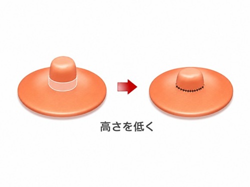 乳頭の高さを低くするイメージ