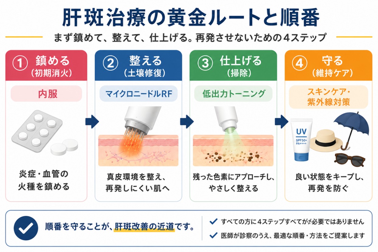 肝斑治療の黄金ルートの順番の図