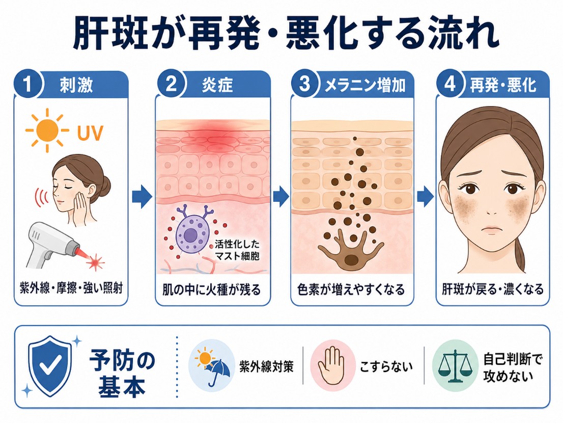 肝斑の再発・悪化の流れ