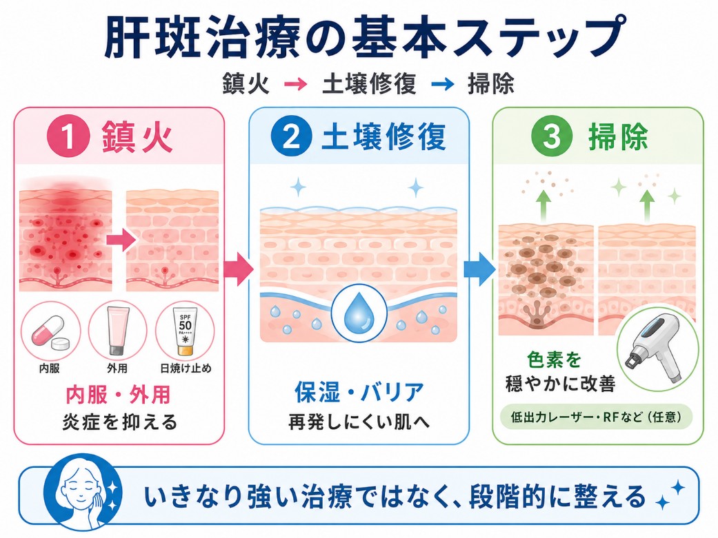 肝斑の治療の基本ステップ
