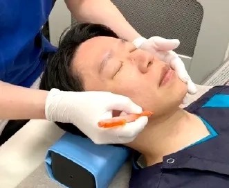 脱毛前のマーキング